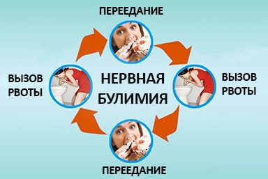 Лечение булимии в Ельце